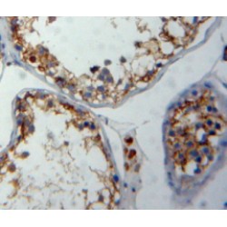 Formin Binding Protein 1 (FNBP1) Antibody