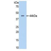 Western blot analysis of recombinant Human PTa (with N-terminal His and GST tags).