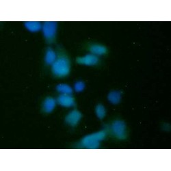 Pancreas Specific Transcription Factor 1a (PTF1a) Antibody