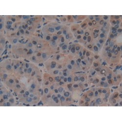 Pancreas Specific Transcription Factor 1a (PTF1a) Antibody