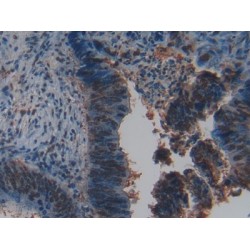 Pancreas Specific Transcription Factor 1a (PTF1a) Antibody