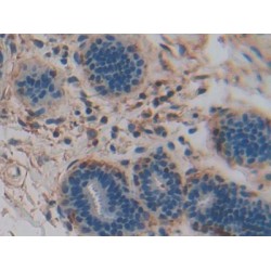 Pancreas Specific Transcription Factor 1a (PTF1a) Antibody