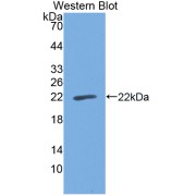 Western blot analysis of the recombinant protein.