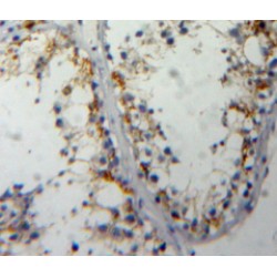 Cell Division Cycle Protein 25 (CDC25) Antibody