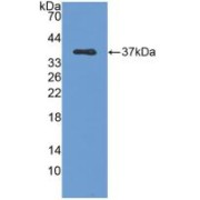 Western blot analysis of recombinant Human RELA.