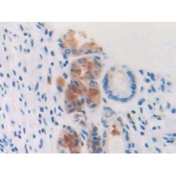 Profilin 3 (PFN3) Antibody