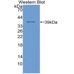 Cardiac Phospholamban (PLN) Antibody