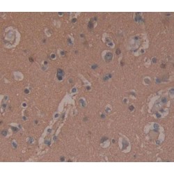 Synaptosomal Associated Protein 25 kDa (SNAP25) Antibody