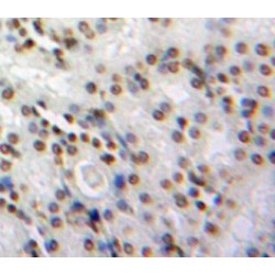 Normal Mucosa of Esophagus Specific 1 (NMES1) Antibody