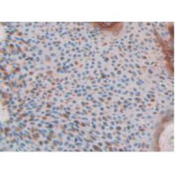 Involucrin (iNV) Antibody