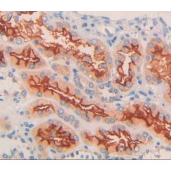 Potassium Chloride Cotransporters 3 (KCC3) Antibody