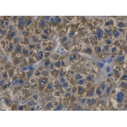 Cyclin Dependent Kinase Inhibitor 3 (CDKN3) Antibody