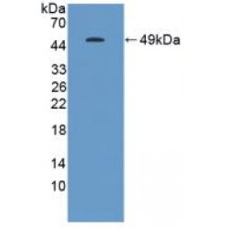 Gastrokine 1 (GKN1) Antibody
