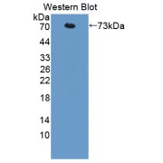 Western blot analysis of the recombinant protein.