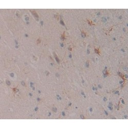 Neuroserpin (NSP) Antibody