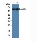 Western blot analysis of (1) Human HeLa cells and (2) Human 293T Cells.