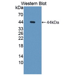 Apoptosis Inhibitor 5 (API5) Antibody