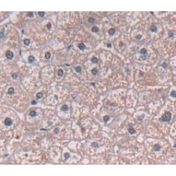 A Disintegrin And Metalloprotease 12 (ADAM12) Antibody