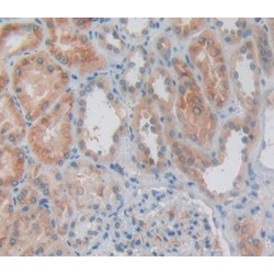 Interleukin 1 Alpha (IL1a) Antibody