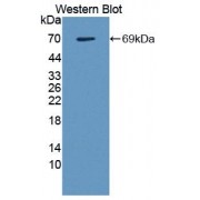 Western blot analysis of recombinant Human GAL9.