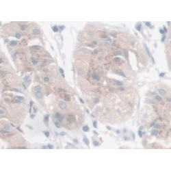 Galectin 9 (LGALS9) Antibody