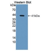 Western blot analysis of the recombinant protein.