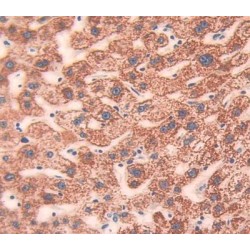 Melanotransferrin (MFI2) Antibody