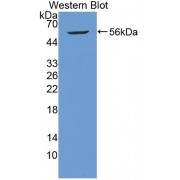 Western blot analysis of the recombinant protein.