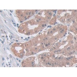 Acid Ceramidase (ASAH1) Antibody