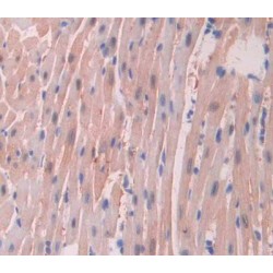 Acid Ceramidase (ASAH1) Antibody