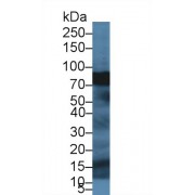 Western blot analysis of Pig Pancreas lysate, using Human SPTbN4 Antibody (1 µg/ml) and HRP-conjugated Goat Anti-Rabbit antibody (<a href="https://www.abbexa.com/index.php?route=product/search&amp;search=abx400043" target="_blank">abx400043</a>, 0.2 µg/ml).