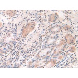 Interferon Gamma Inducible Protein 30 (IFI30) Antibody