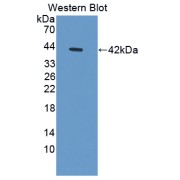 Western blot analysis of recombinant Human PTMa.