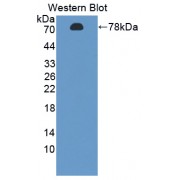 Western blot analysis of recombinant FDPS.