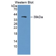 Western blot analysis of the recombinant protein.