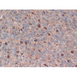 S100 Calcium Binding Protein A14 (S100A14) Antibody