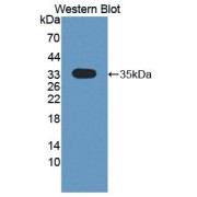 Western blot analysis of the recombinant protein.