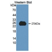 Western blot analysis of recombinant Human SPP2.