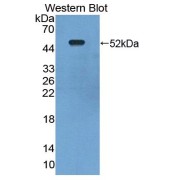 Western blot analysis of the recombinant protein.