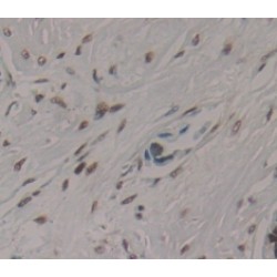 AF4/FMR2 Family, Member 1 (AFF1) Antibody