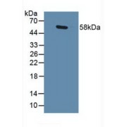 Western blot analysis of Human Lung Tissue.