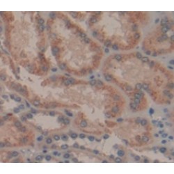 Autophagy Related Protein 16 Like Protein 1 (ATG16L1) Antibody