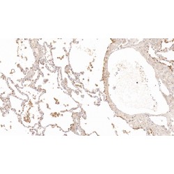 Surfactant Protein A1 (SFTPA1) Antibody