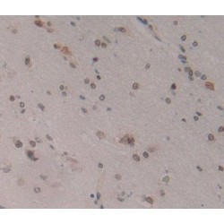 Cyclin Dependent Kinase 8 (CDK8) Antibody