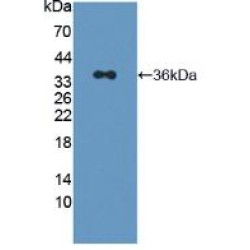 Insulin Receptor Substrate 2 (IRS2) Antibody