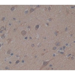 Baculoviral IAP Repeat Containing Protein 6 (BIRC6) Antibody