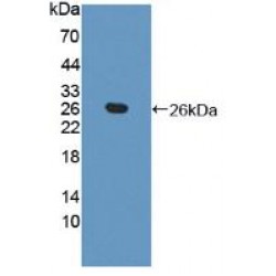 Transgelin 2 (TAGLN2) Antibody