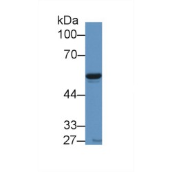 Nicotinamide Phosphoribosyltransferase / Visfatin (NAMPT) Antibody