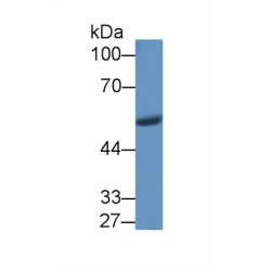 Nicotinamide Phosphoribosyltransferase / Visfatin (NAMPT) Antibody