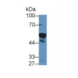 Nicotinamide Phosphoribosyltransferase / Visfatin (NAMPT) Antibody